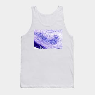 Venule, light micrograph (C021/4883) Tank Top